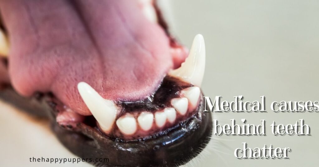 Medical causes behind teeth chatter
